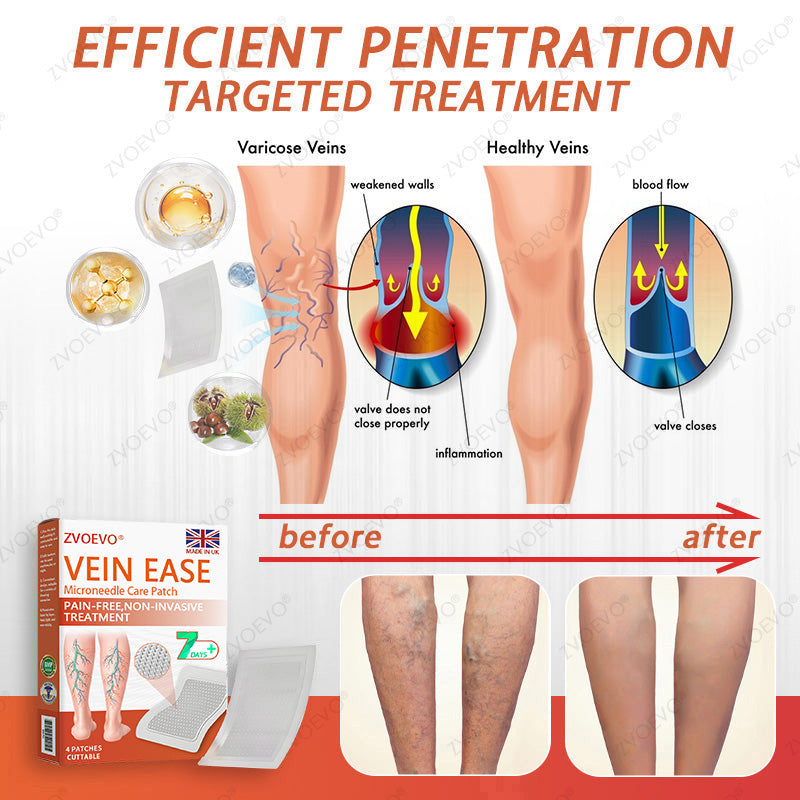 🪸💎Zvoevo® Vein Ease Microneedle Care Patch(For Spider Veins, Varicose Veins, Swelling & Leg Fatigue) - Last Day Promotion 50% OFF