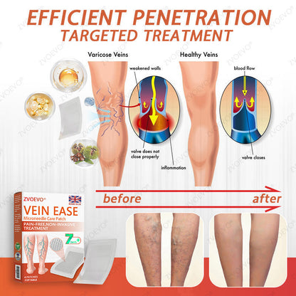 🪸💎Zvoevo® Vein Ease Microneedle Care Patch(For Spider Veins, Varicose Veins, Swelling & Leg Fatigue) - Last Day Promotion 50% OFF