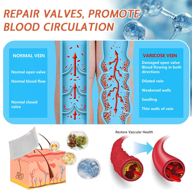 🪸💎Zvoevo® Vein Ease Microneedle Care Patch(For Spider Veins, Varicose Veins, Swelling & Leg Fatigue) - Last Day Promotion 50% OFF