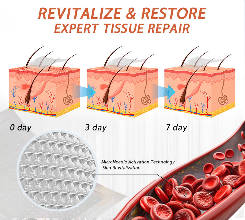 🪸💎Zvoevo® Vein Ease Microneedle Care Patch(For Spider Veins, Varicose Veins, Swelling & Leg Fatigue) - Last Day Promotion 50% OFF