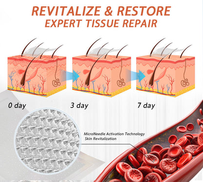 🪸💎Zvoevo® Vein Ease Microneedle Care Patch(For Spider Veins, Varicose Veins, Swelling & Leg Fatigue) - Last Day Promotion 50% OFF